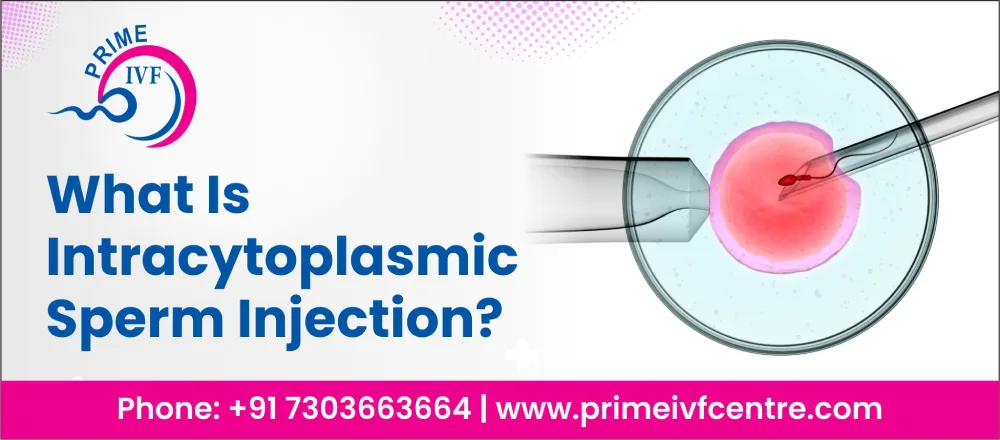 What is intracytoplasmic sperm injection (ICSI)? | Prime Ivf